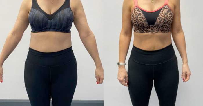 Pharmacists warn demand for weight loss jabs may outstrip supply