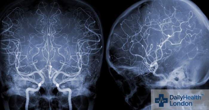 Redefining Surgical Intelligence: Professor Kagan Dincer Introduces iFlow, Revolutionising Operative Precision