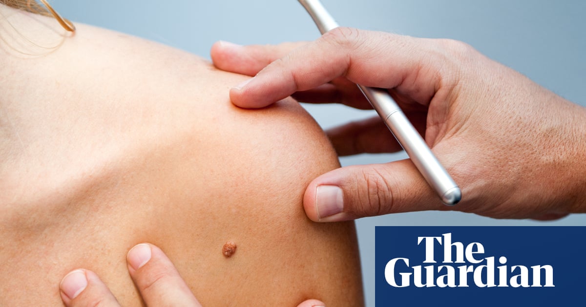 Be warned about the dangers of tanning | Brief letters