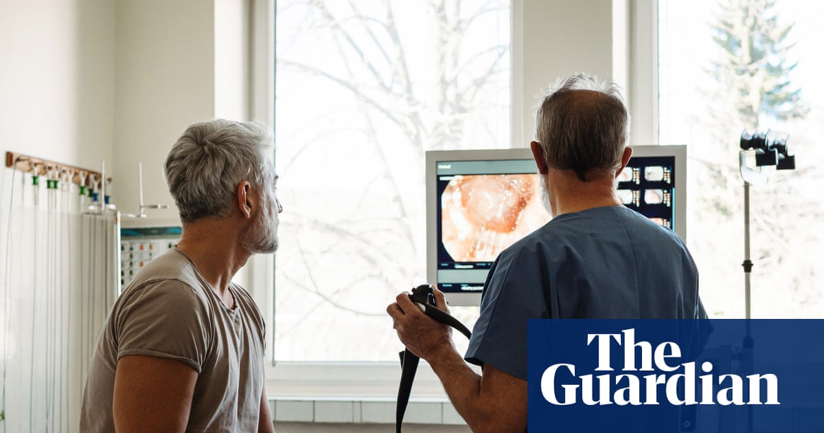 What is a colonoscopy and should I get one?