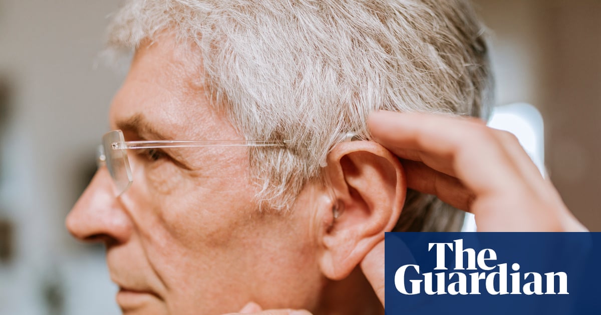 ‘Hi-tech’ hearing aids are also available on the NHS | Letters